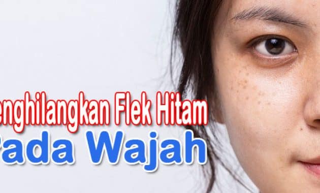 cara menghilangkan flek hitam di wajah yang membandel