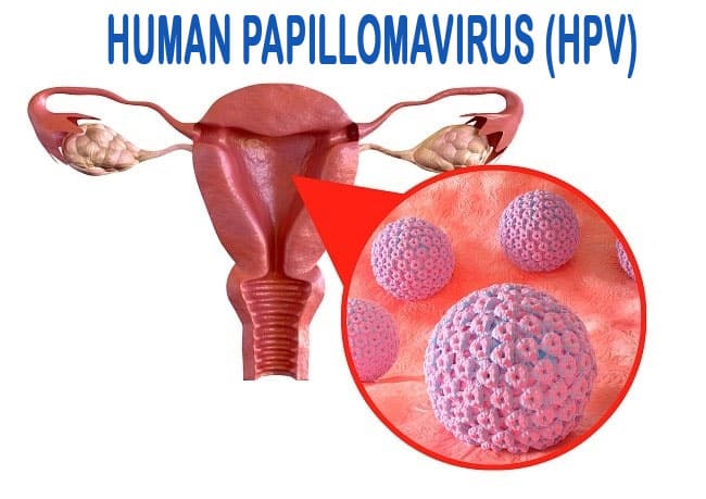 HPV